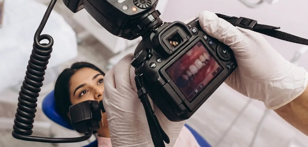Intraoral Photography