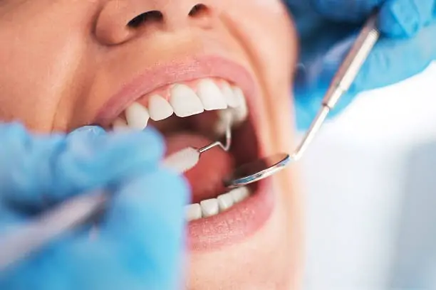 Tooth Wear & Full Mouth Rehabilitation