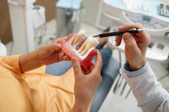 Implants and Guided Surgery